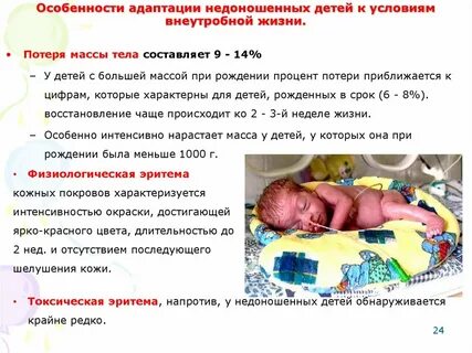 Какой ребенок считается недоношенным срок