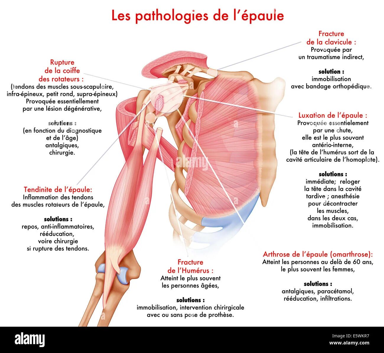 Anatomie d une chute