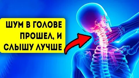 Постоянно шумит в голове причины