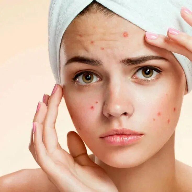 Problem skin. Problem skin