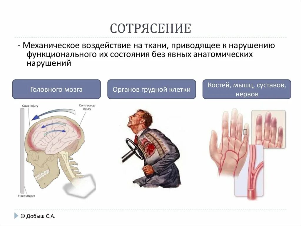 Сотрясение тканей