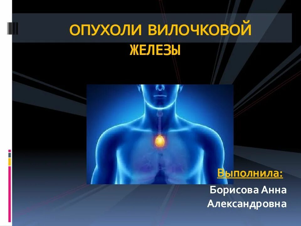 Вилочковая железа рак. Вилочковая железа рак. Опухоли средостения тимома. Вилочковая железа располагается. Морфологическая классификация опухолей воз.