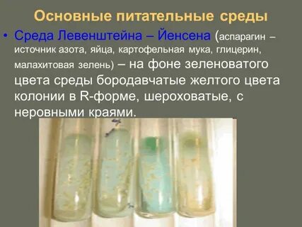 Среда для микобактерий туберкулеза