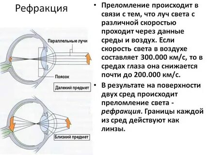 Что значит точка в глазу