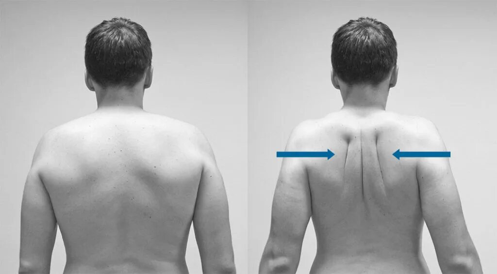 Асимметрия сустава. Атланто-окципитальное сочленение рентген. Остеоартроз голеностопного сустава рентген. Сколиоз позвоночника. Спина.