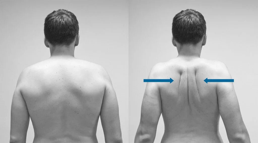 Ровный позвоночник. Ровная спина. Сведение лопаток упражнение. Почему плечи вверх