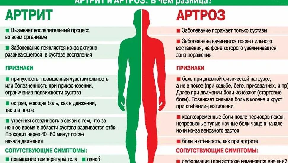 Какие боли в суставах. Разница между артритом и артрозом. Чем отличается артрит от артроза.