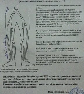 Варикозная трансформация притоков бпв
