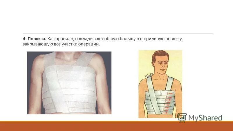 при переломах и ушибах ребер необходимо. пмп при переломе ребер алгоритм. при переломах и ушибах ребер необходимо. бинтование при переломе ребер. рои перелоие ребер первая помощь.