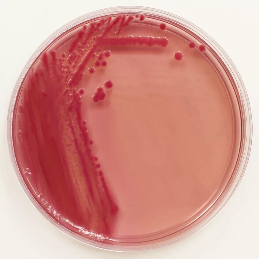 Ба агар. Агар МАККОНКИ. E. coli на агар МАККОНКИ. Иерсиния агар МАККОНКИ.