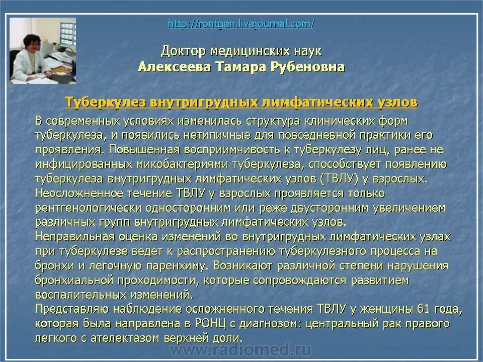 Туберкулез вести