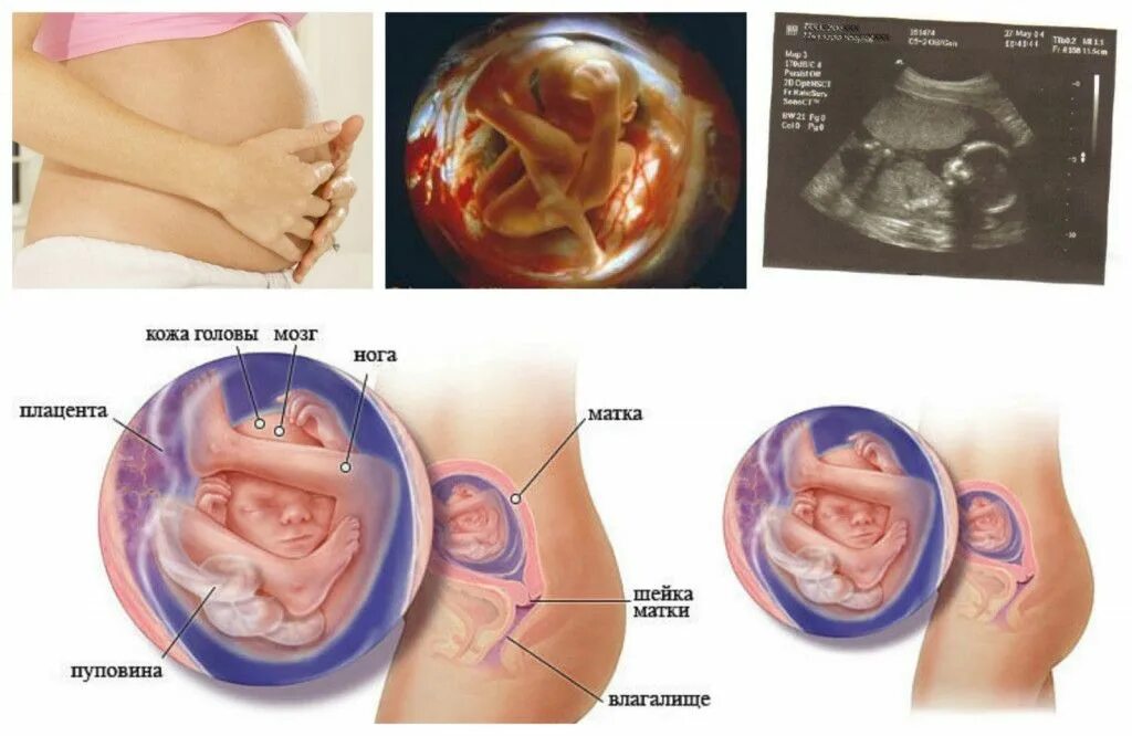 Беременность срок 17 недель. Размер малыша на 18 неделе беременности. Плод 18 недель беременности живот. Плод на 18 неделе беременности. Ребёнок на 18 неделе беременности.