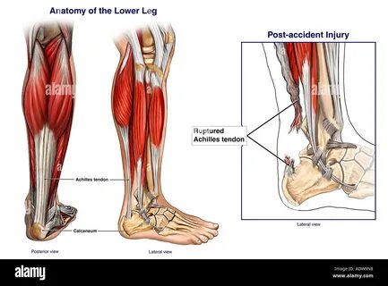 Lower leg