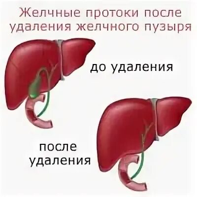 Удаление желчного пузыря в возрасте