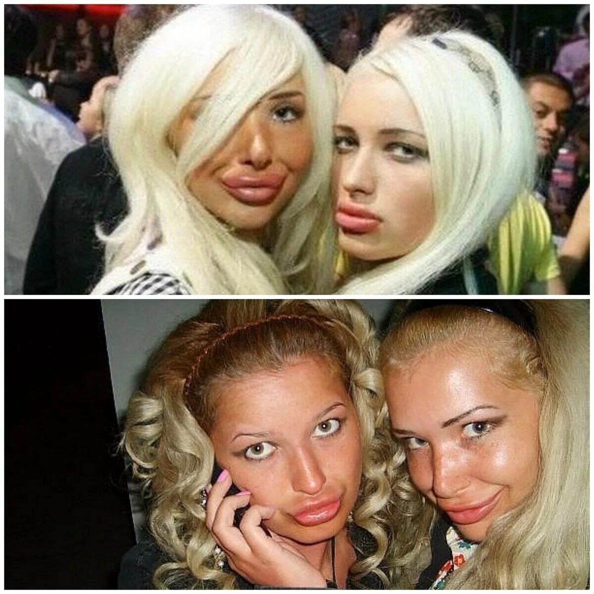 Губы дакфейс. Девки с утиными губами. Утиные губы у девушек. Утиные губы у девушек. Губки уточкой.