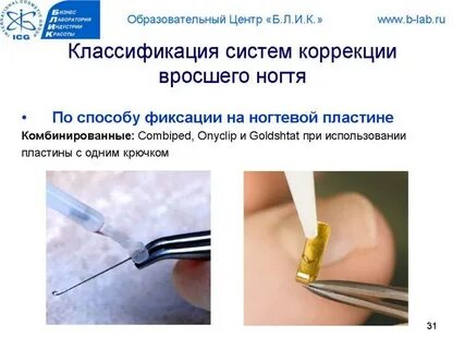 Коррекция врасти