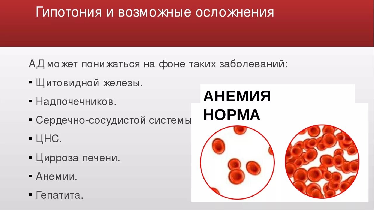 Гипотония это какое. Осложнения гипотензии. Осложнения гипотонии. Гипотензия признаки. Сосуды при гипотензии.