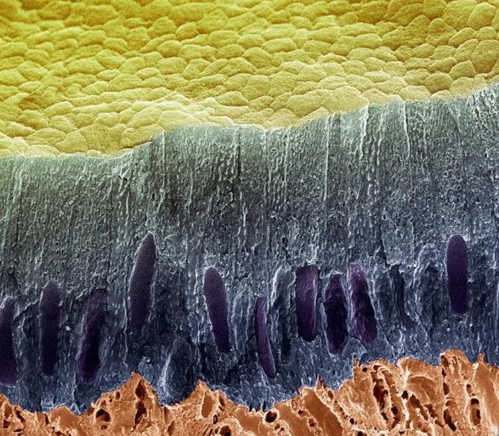 Слизистые покровы или гладкая поверхность. Кариес под микроскопом бактерии. Деттин под микроскопом. Эмаль зуба под микроскопом. Зубная эмаль под микроскопом.