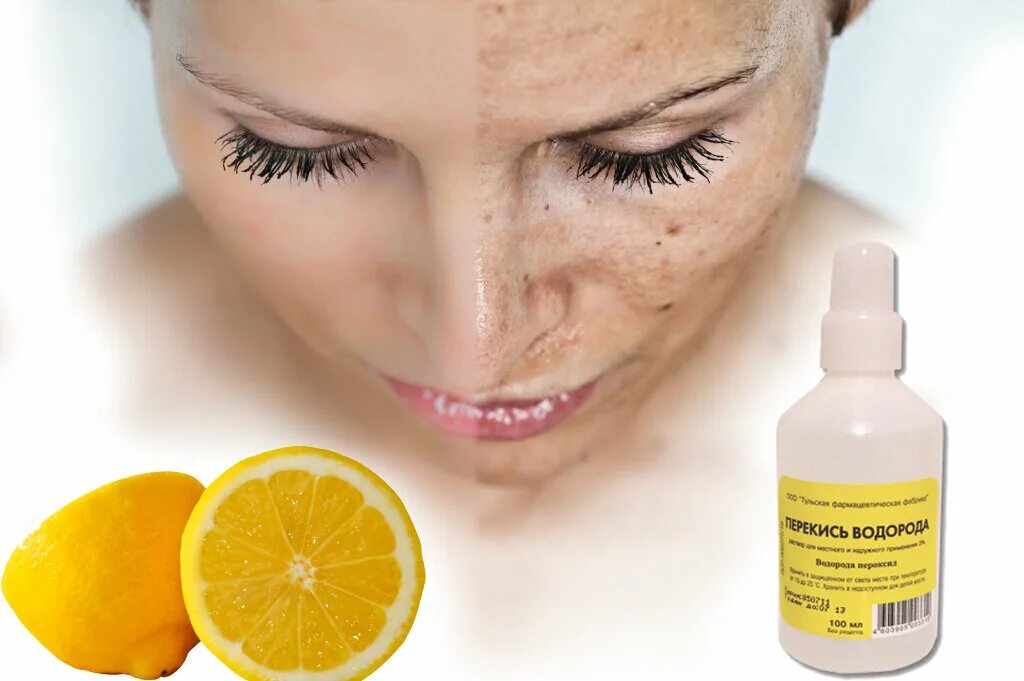 Лимон для лица отбеливание. Отбеливающее от пигментации на лице. Отбеливание кожи от пигментации. Отбеливание маска домашний