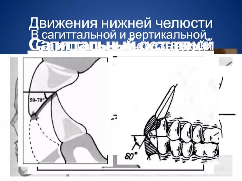 Угол сагиттального резцового пути. Сагиттальный суставной путь. сагиттальные движения нижней челюсти. угол сагиттального суставного и резцового пути.