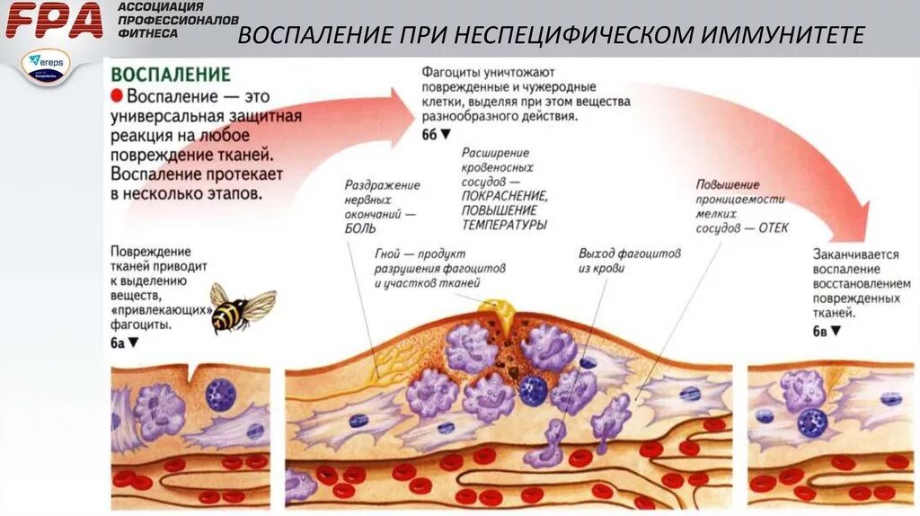 Воспаление при неспецифическом иммунитете\. Воспалительная реакция. Воспалительный процесс в организме. Реакция организма клетки на