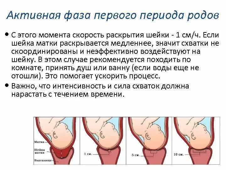 Раскрытие шейки матки при родах. Периоды родов раскрытие шейки матки. Раскрытие матка природах. Шейка готова когда роды