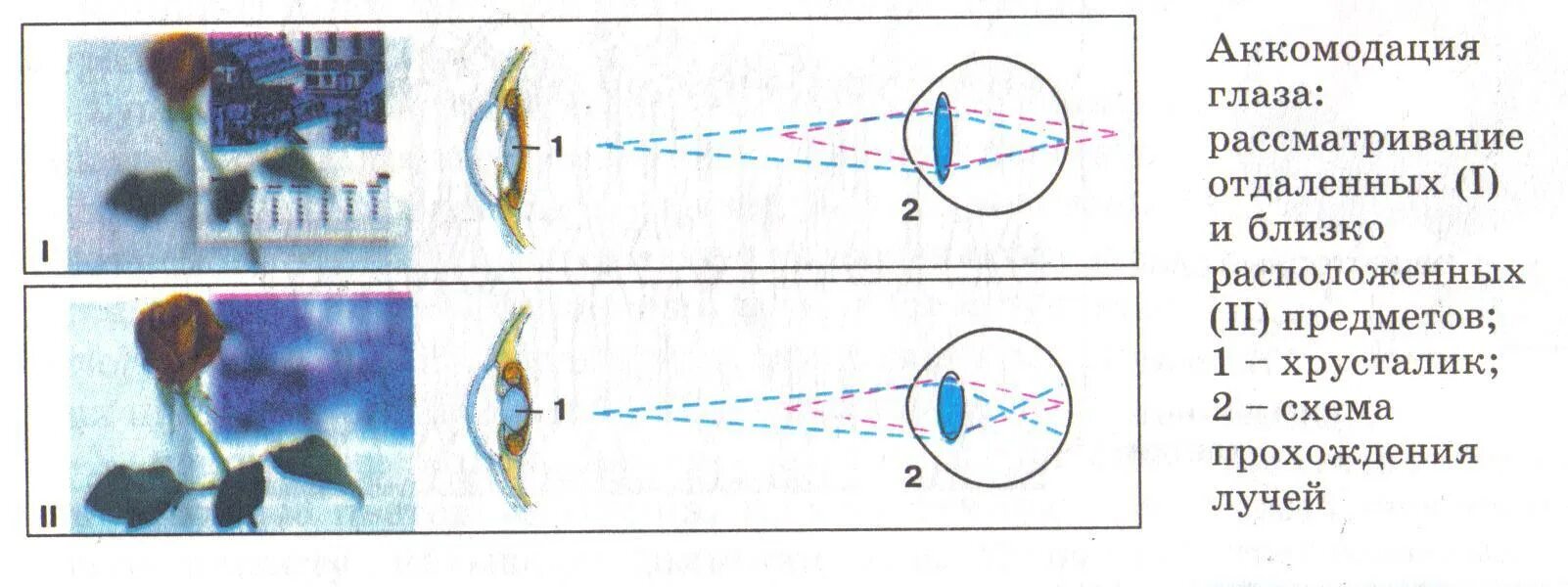 Схема преломления лучей света хрусталиком глаза. Схема преломления лучей хрусталиком глаза при близорукости. Схема аккомодации хрусталика. Нарисуйте схему преломления лучей хрусталиком глаза. Видят в ней абсолютный