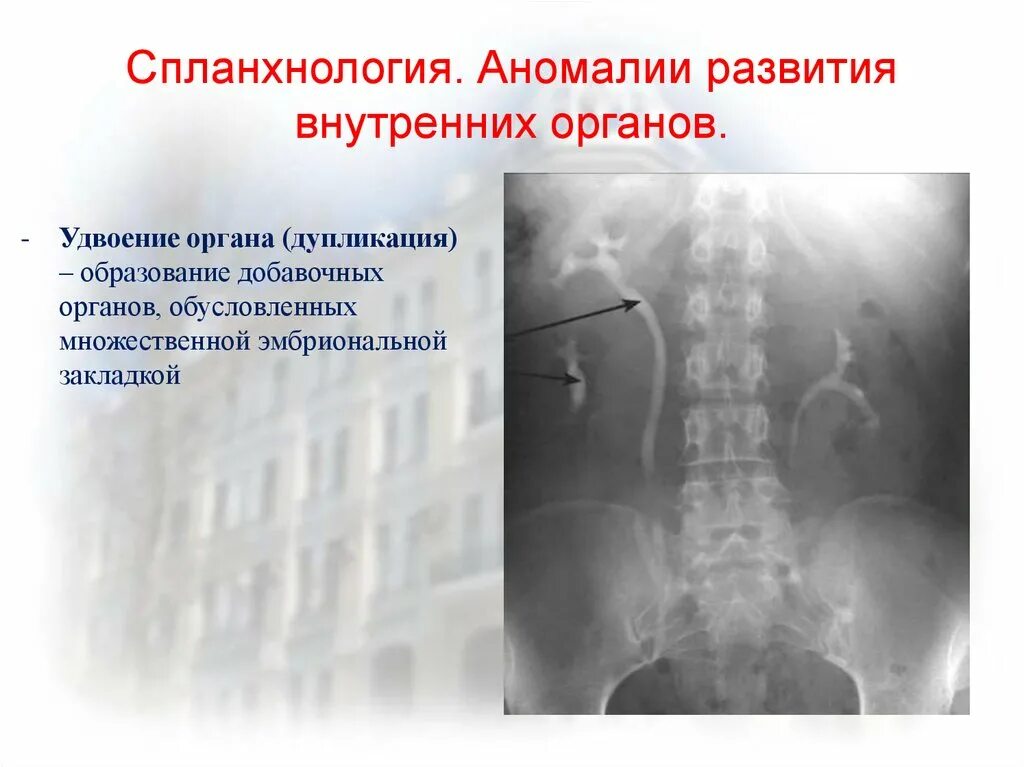 Дупликация органа это. Аномалии развития органов. Пороки развития внутренних органов. Классификация аномалий развития внутренних органов.