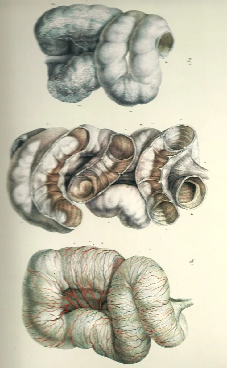 Кишечник анатомия тонкая кишка. Тонкий кишечник анатомия. Тонкая кишка анатомия человека рисунок. Наброски частей тела человека. Позы для рисования убийц.