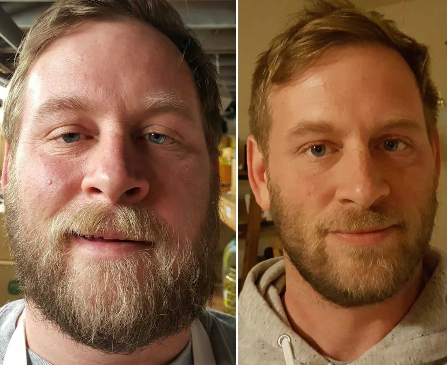 Отражается на внешность. Пропитое лицо до и после. Лицо до и после алкоголизма. Лицо алкоголика до и после отказа.
