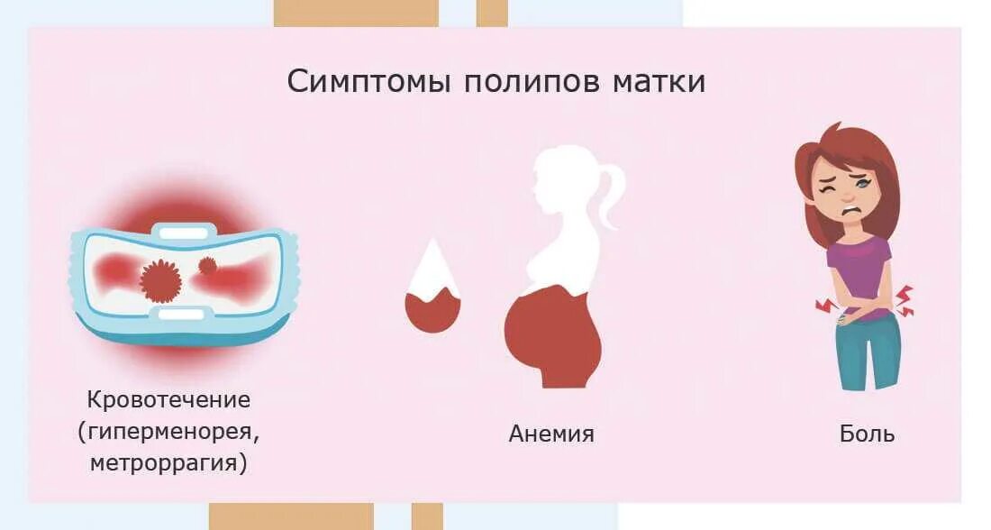 Как отличить обильные. Симптомы полипа в матке кровотечения. Полип шейки матки кровотечения.