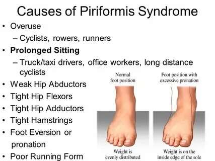 Footing forms
