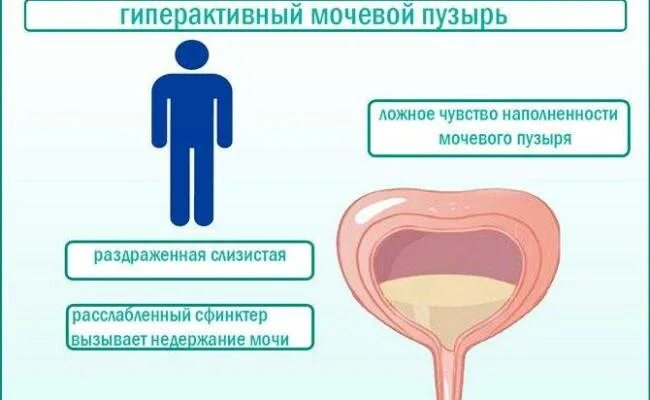 Непроизвольное Мочеиспускание У Женщин Во Время Секса