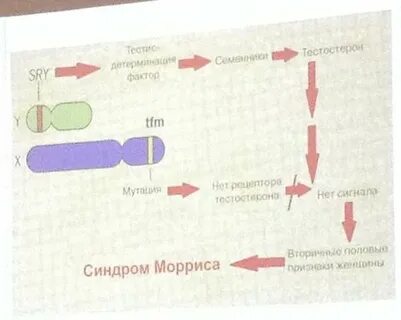 Синдром морриса у женщин