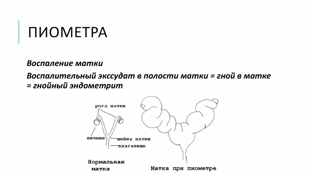 Какая матка при воспалении