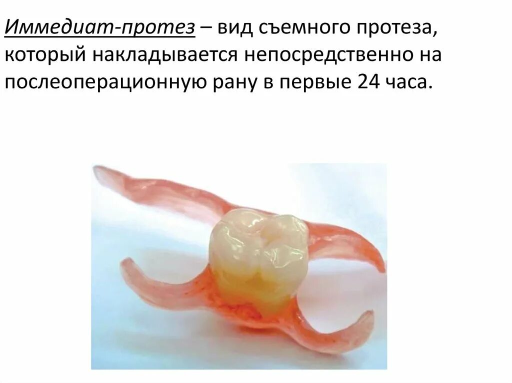 Изготовление иммедиат протеза. Несъемные иммедиат-протезы. Иммедиат протез строение.