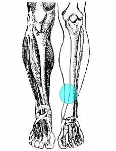 Fractura pedis transversa