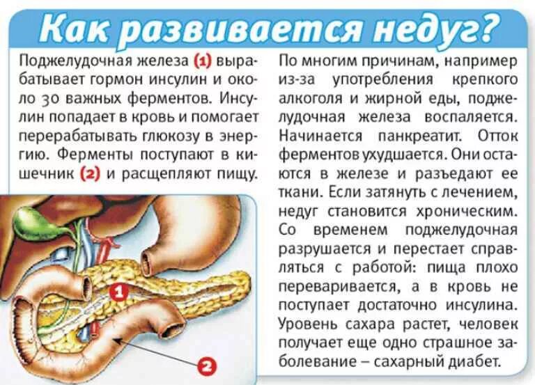 Панкреатит симптомы заболевания. Поджелудочная железа симптомы. Что такое панкреатит поджелудочной.