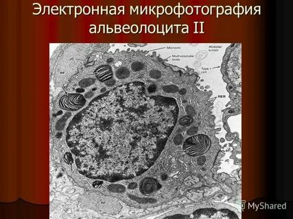 Рассмотрите микрофотографию