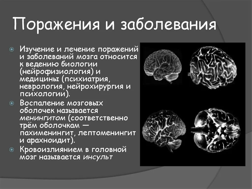 Название болезней головного мозга перечень. Поражение головного мозга. Патология головного мозга. Болезнь головного мозга название болезни.