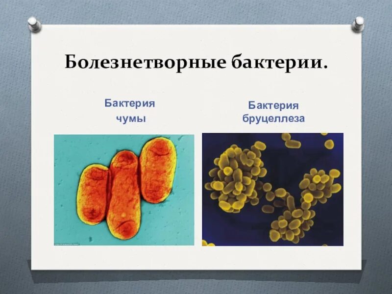 Болезнетворная бактерия 7. Строение болезнетворных бактерий. Что такое болезнетворные бактерии в биологии. Болезнетворные бактерии 5 класс. Виды болезнетворных бактерий 5 класс.