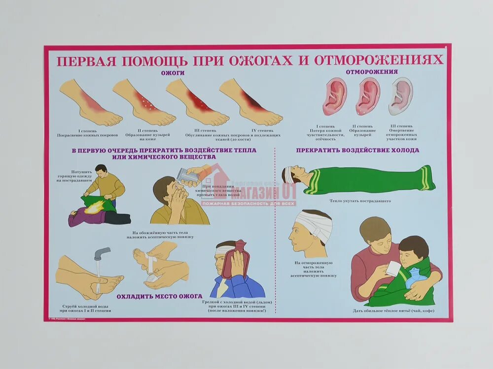 1 помощь при ожогах и отморожениях. Оказание первой медицинской помощи при ожогах. оказание первой доврачебной помощи при ожогах и обморожениях. оказание первой медпомощи при ожогах. плакат оказание первой медицинской помощи при ожогах.