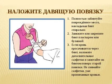 В каком случае следует накладывать давящую повязку