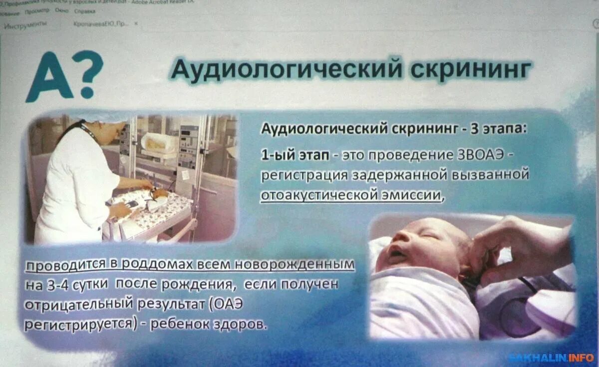 Скрининг роддом какие. Неонатальный и аудиологический скрининг новорожденных. аудиологический скрининг. аудиологический скрининг новорожденных. аудиологический скрининг заключение.