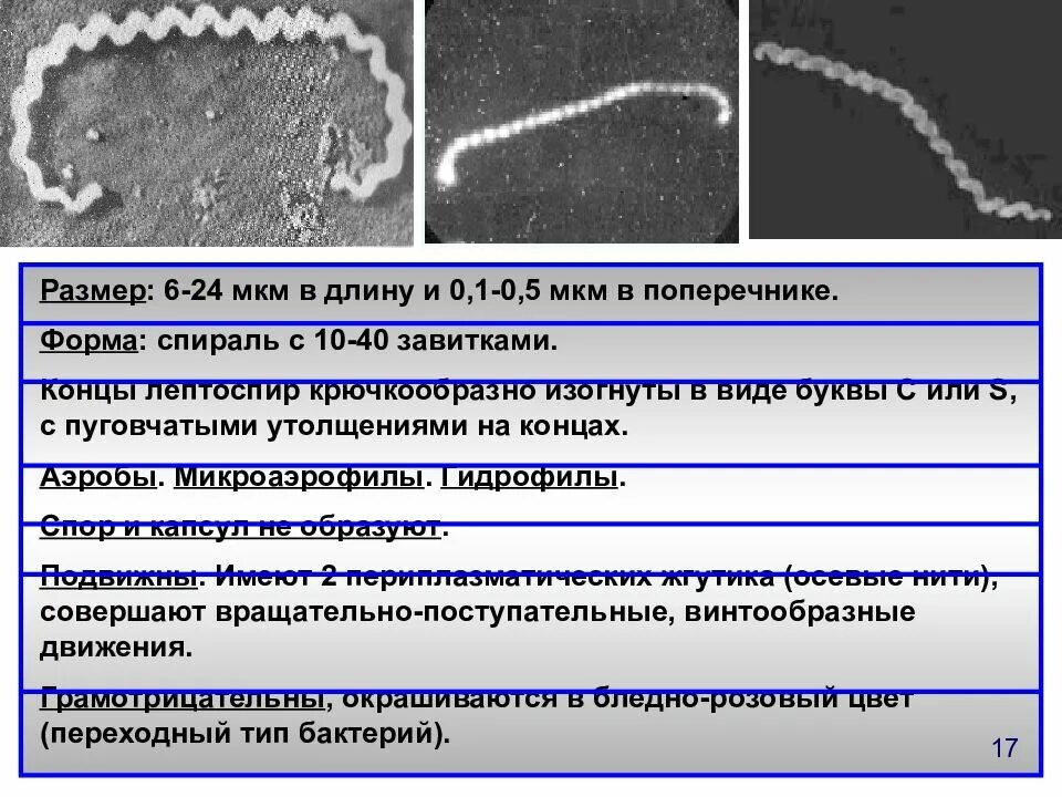 Лептоспироз возбудитель. Лептоспиры микробиология. Лептоспиры возбудитель. Лептоспироз гепатит