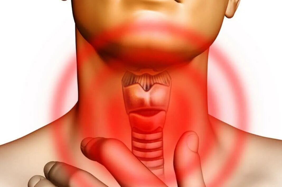 Болит горло можно ли