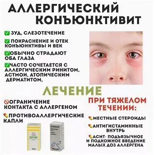 Народные средства от конъюнктивита взрослым