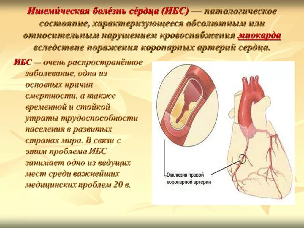 Области ишемии. Заболевания сердца презентация.