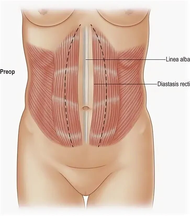 Coolsculpting North Vancouver Fat Freezing Treatments at EverYoungMed