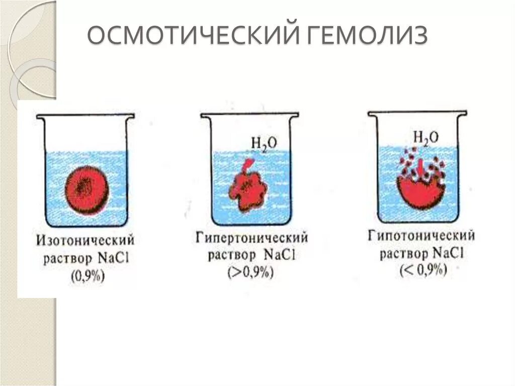 Гемолиз эритроцитов в крови. Причины осмотического гемолиза эритроцитов. Изотонический раствор схема. Термический гемолиз. Эритроциты в растворе хлорида натрия